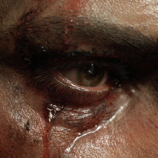 Close-up of a person's eye with bloodshot appearance